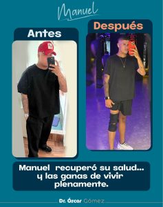 Copy of dr oscar antes y despues 1