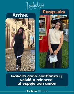 Copy of dr oscar antes y despues 2