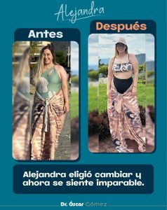 Copy of dr oscar antes y despues 4