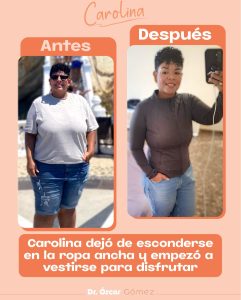 dr oscar antes y despues JUNIO 1