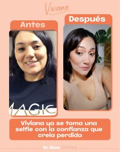 dr oscar antes y despues JUNIO 2