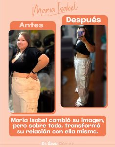 dr oscar antes y despues JUNIO 3